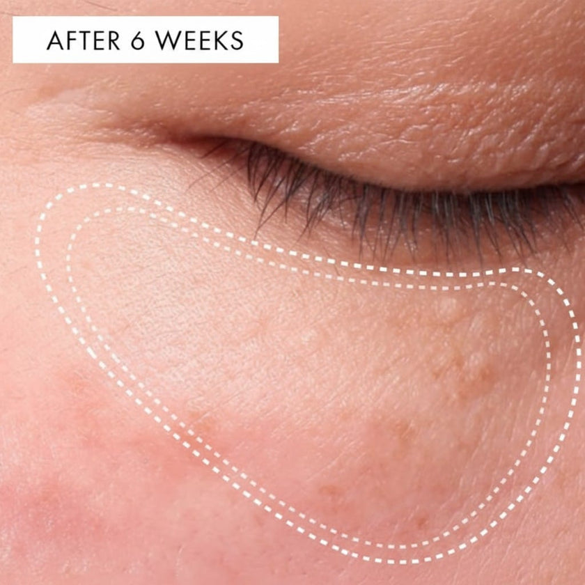 Before / After — after
