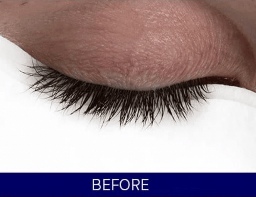 Before / After — before
