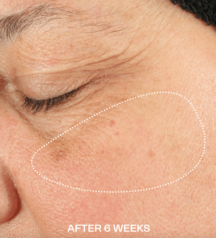 Before / After — after