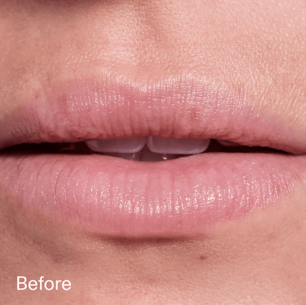 Before / After — before