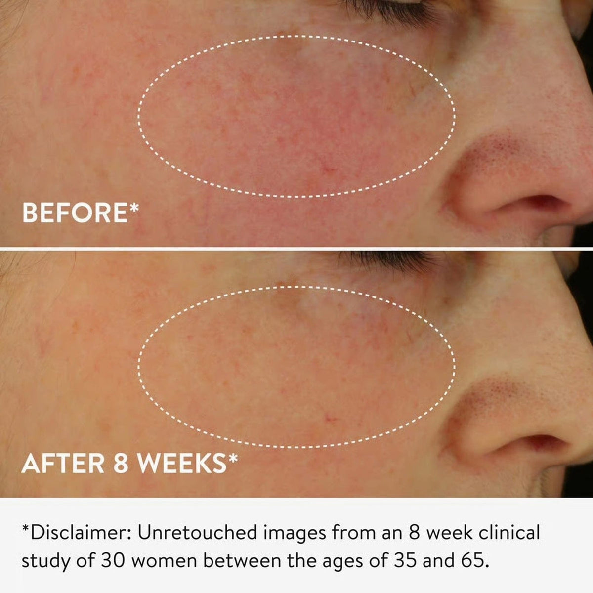 Dark Spot Exfoliating Sleep Milk