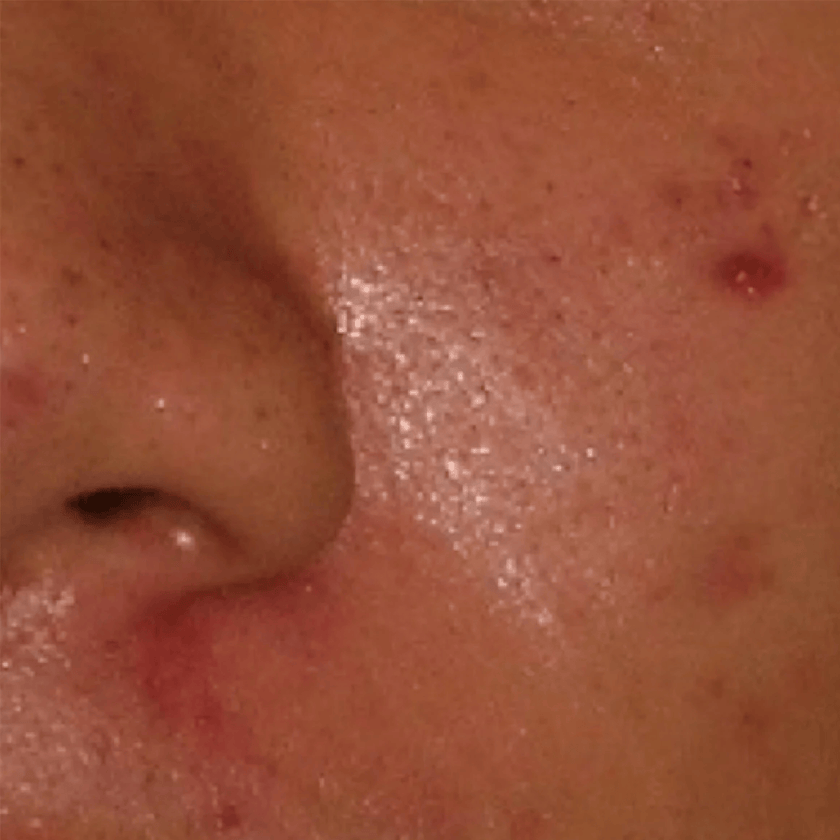 Before / After — before