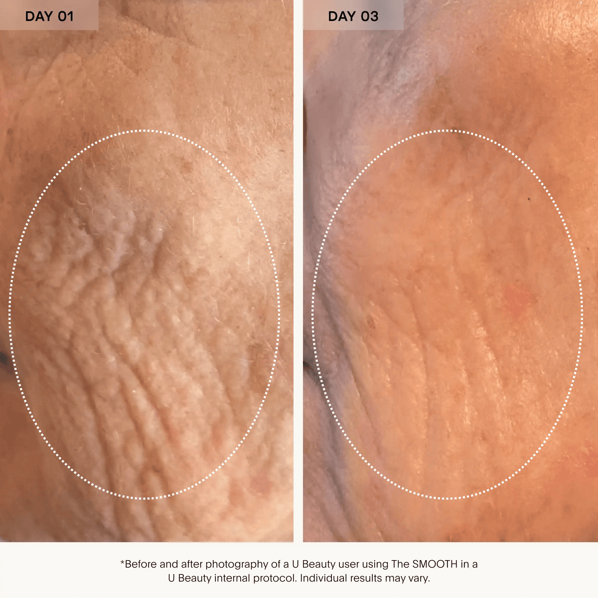 The SMOOTH Dynamic Wrinkle Defense Serum